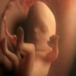 Hamilelikte 5.Ay 16-20 Hafta