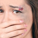 Şiddet Mağduru Kadına Estetik Desteği