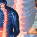 Çocuklarda Omurga Eğriliği Nasıl Tedavi Edilir?