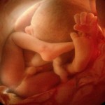 Anne Karnındaki Bebek Tuvaletini Yapıyor mu?