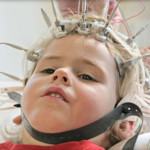 Çocuk EEG Nedir? Nasıl Yapılır?