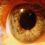 Sarı Nokta Hastalığına Karşı Vitamin