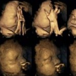 Sigaranın Anne Karnındaki Bebeğe Etkisi Görüntülendi