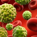 Kanserden korunmanın 10 altın kuralı !