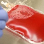 Kordon Kanı Alma Koşulları Nasıl Olmalı?