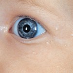 Yenidoğanların Normal Döküntüleri