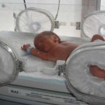 Her 10 Bebekten İkisi Prematüre Doğuyor