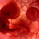 Beyin Gelişimi Gebelikte Ne Zaman Başlar?